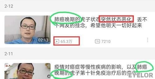 所谓的理财专家或名人是否靠谱 - EYELOR美妆